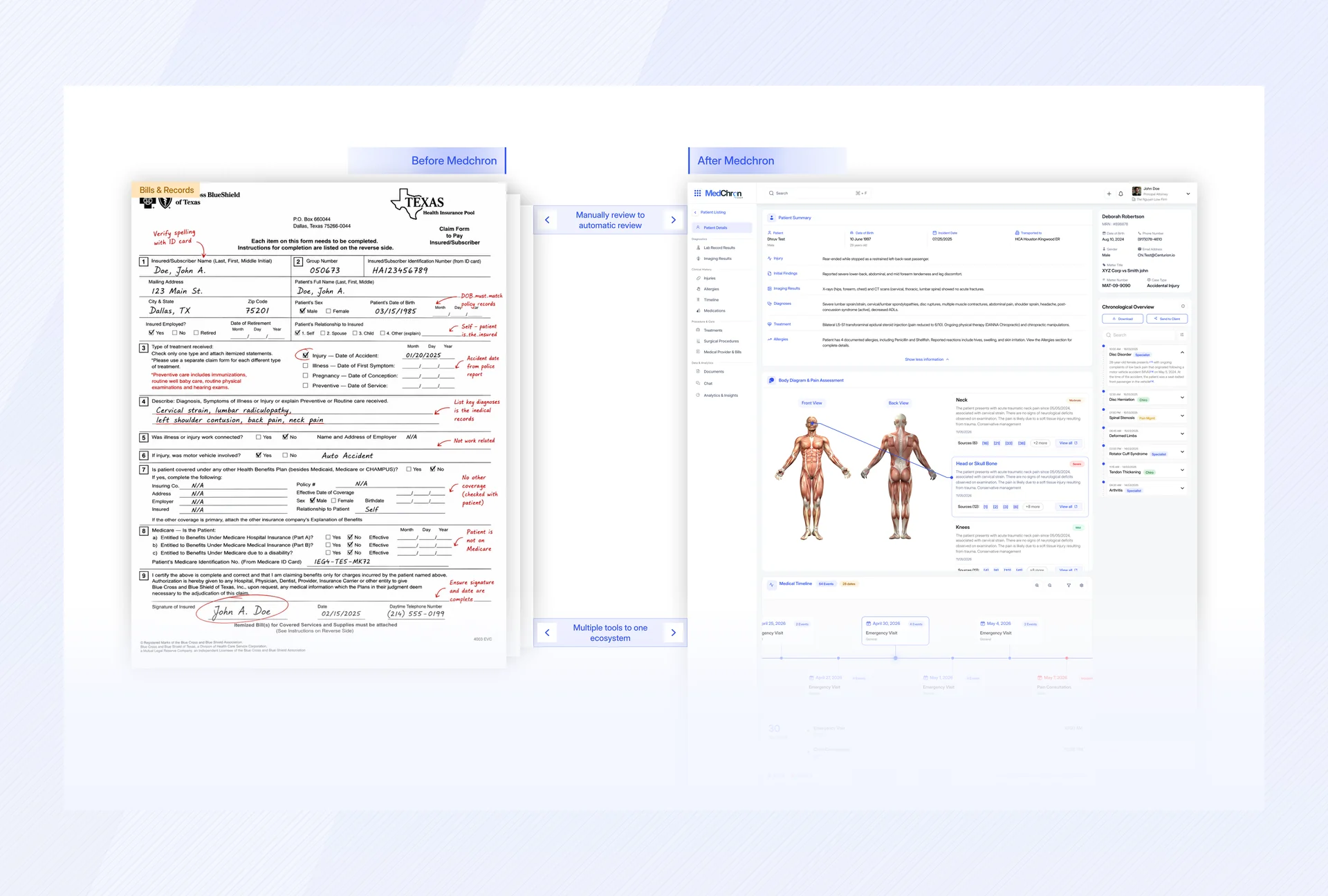 MedChron — Turning Complex Medical Records Into Actionable Insights